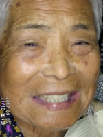 治療前の状態
