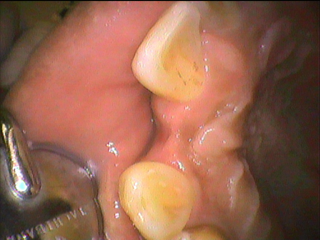 治療例 191