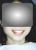 治療前の状態