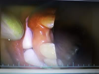 治療例 148